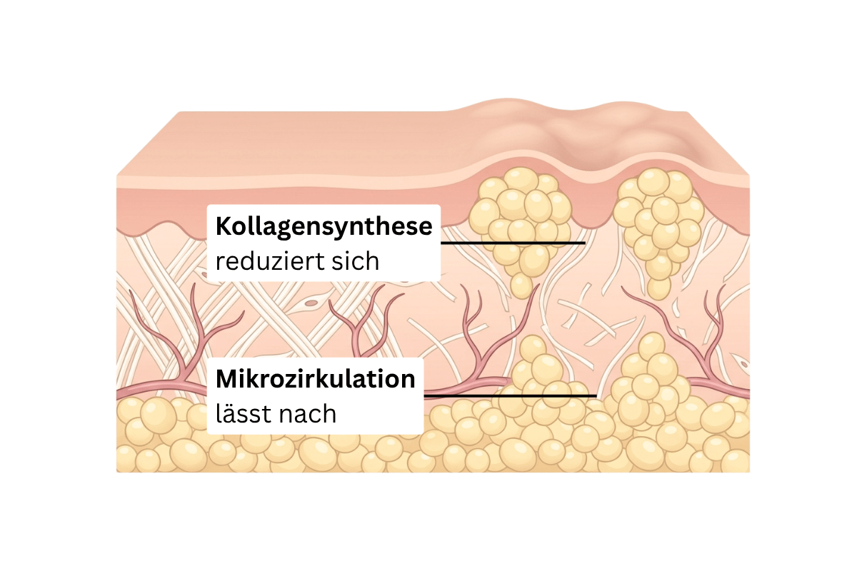 Illustration: Mit den Jahren reduziert sich die Kollagensynthese und die Mikrozirkulation lässt nach