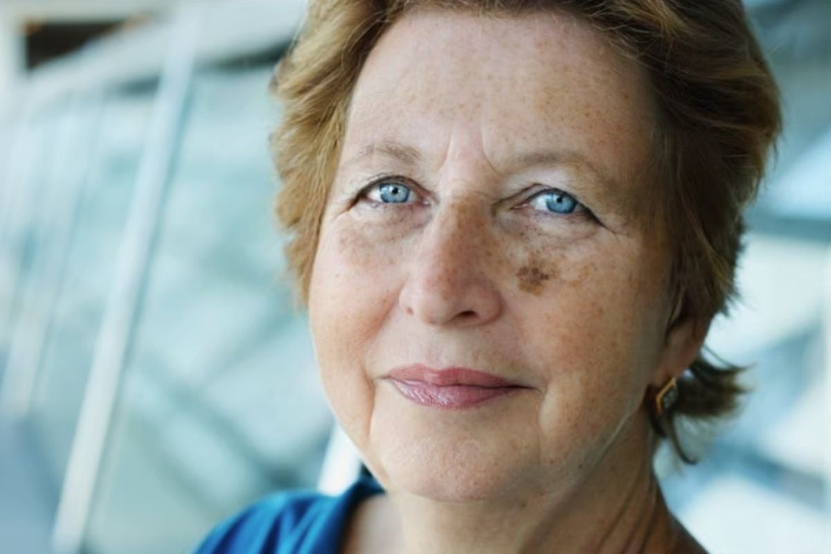 Marion, 64, mit sichtbaren Pigmentflecken im Gesicht